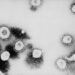CDC confirms second case of Coronavirus inside United States