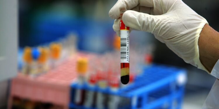 First case of Omicron variant detected in the United States