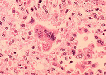 (Photo by CDC via Getty Images)