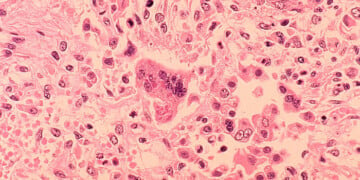 (Photo by CDC via Getty Images)