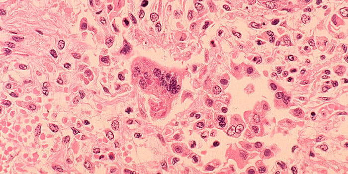 (Photo by CDC via Getty Images)