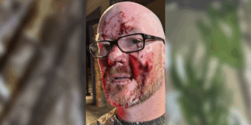 Wisconsin boy saves dad from bear attack