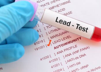 Milwaukee Health Commissioner confirms the return of CDC lead team