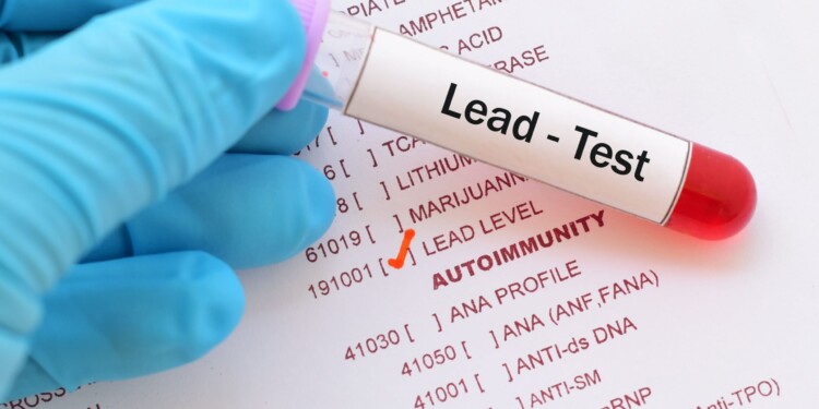 Milwaukee Health Commissioner confirms the return of CDC lead team