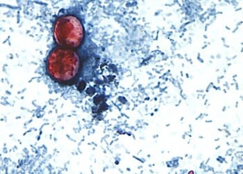 Photomicrograph of a fresh stool sample prepared in a 10% formalin solution and stained with safranin, showing three uniformly stained Cyclospora cayetanensis oocysts within the field of view, 2000. Courtesy CDC. (Photo by Smith Collection/Gado/Getty Images)