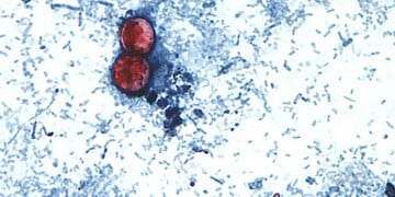 Photomicrograph of a fresh stool sample prepared in a 10% formalin solution and stained with safranin, showing three uniformly stained Cyclospora cayetanensis oocysts within the field of view, 2000. Courtesy CDC. (Photo by Smith Collection/Gado/Getty Images)