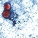 Photomicrograph of a fresh stool sample prepared in a 10% formalin solution and stained with safranin, showing three uniformly stained Cyclospora cayetanensis oocysts within the field of view, 2000. Courtesy CDC. (Photo by Smith Collection/Gado/Getty Images)
