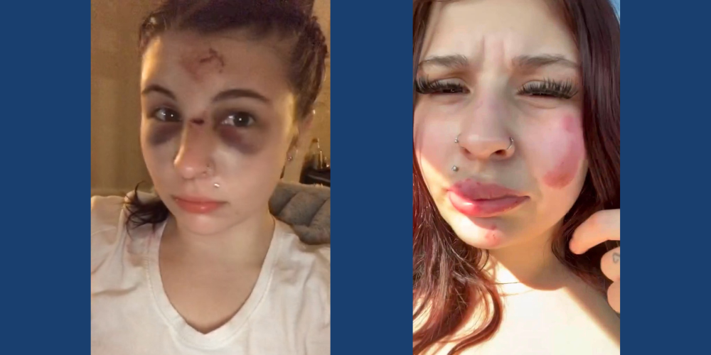 Images of Hailie Wagner courtesy of her family.