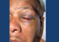 Image of injured Timothy "Keys" Sellers, courtesy of his family.