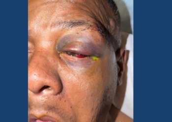 Image of injured Timothy "Keys" Sellers, courtesy of his family.