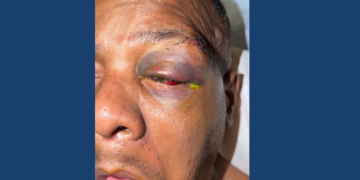 Image of injured Timothy "Keys" Sellers, courtesy of his family.