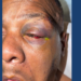 Image of injured Timothy "Keys" Sellers, courtesy of his family.