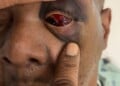 Image of injured Timothy "Keys" Sellers, courtesy of his family.