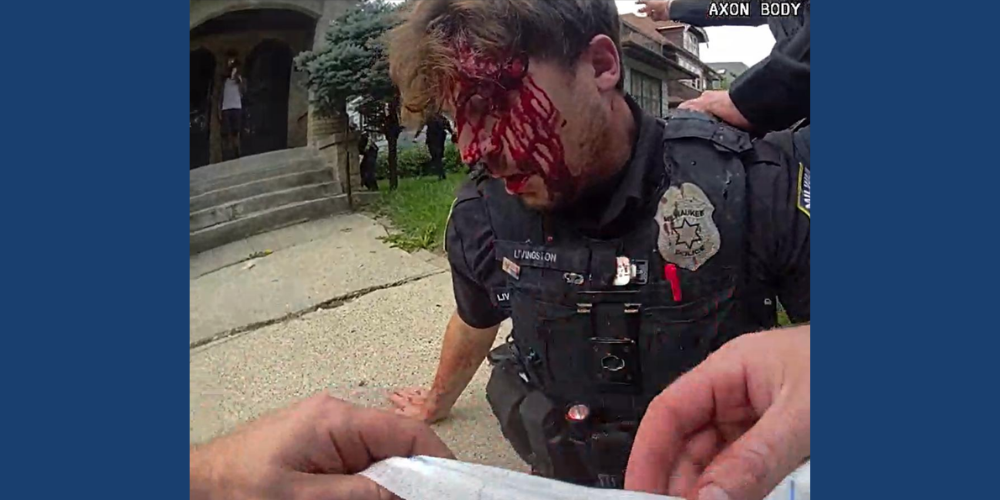 Image from body camera from Milwaukee Police Officer Goodchild showing injuries to Officer Livingston from incident on October 14, 2026. Image courtesy of Milwaukee Police.