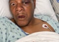 Image of injured Timothy "Keys" Sellers, courtesy of his family.
