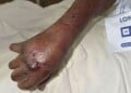 Image of injured Timothy "Keys" Sellers, courtesy of his family.