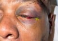 Image of injured Timothy "Keys" Sellers, courtesy of his family.